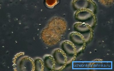 Una gota bajo el microscopio: la foto muestra las algas simples y microorganismos Una gota bajo el microscopio: la foto muestra las algas simples y microorganismos