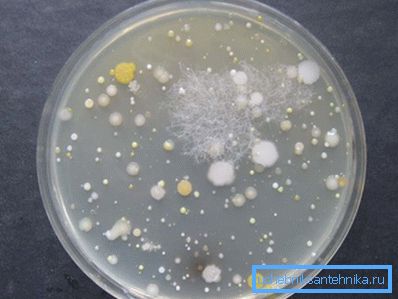 En la foto - bacterias en el agua. En la foto - bacterias en el agua.