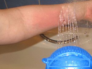 Tratamiento de la manilla con dispositivo de hidromasaje. Tratamiento de la manilla con dispositivo de hidromasaje.