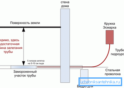 Diagrama del uso del nivel hidroeléctrico y de los círculos de Esmarch. Diagrama del uso del nivel hidroeléctrico y de los círculos de Esmarch.